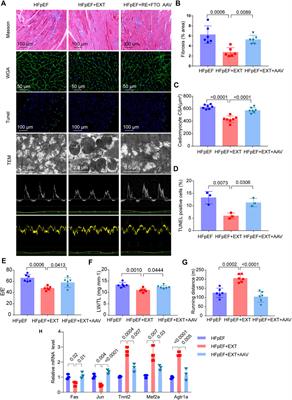 Exercise training ameliorates myocardial phenotypes in heart failure with preserved ejection fraction by changing N6-methyladenosine modification in mice model